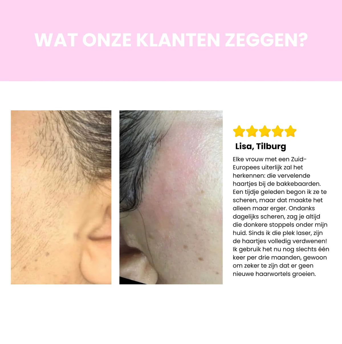 Sidea IPL Haarverwijderaar