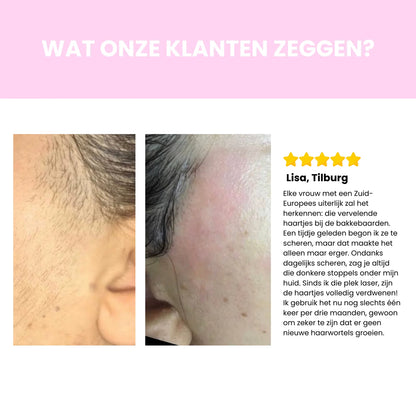 Sidea IPL Haarverwijderaar