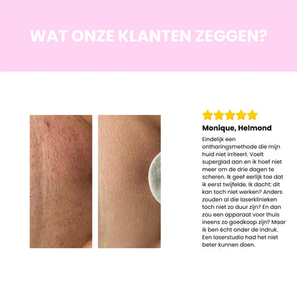 Sidea IPL Haarverwijderaar